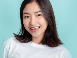 Dental Sealants Effective Protectants for Molars