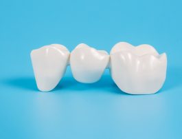 Types of Dental Bridges: Benefits of Dental Bridges