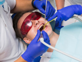 How Long Is Recovery After a Dental Extraction in Clearwater?