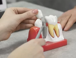 The Emotional Benefits of Restoring Your Smile with Dental Implants
